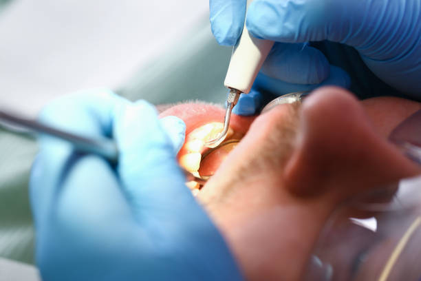 Best Emergency TMJ Treatment in Middlefield, OH