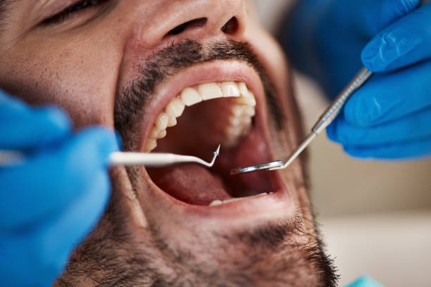 Best Weekend Emergency Dentist in Middlefield, OH